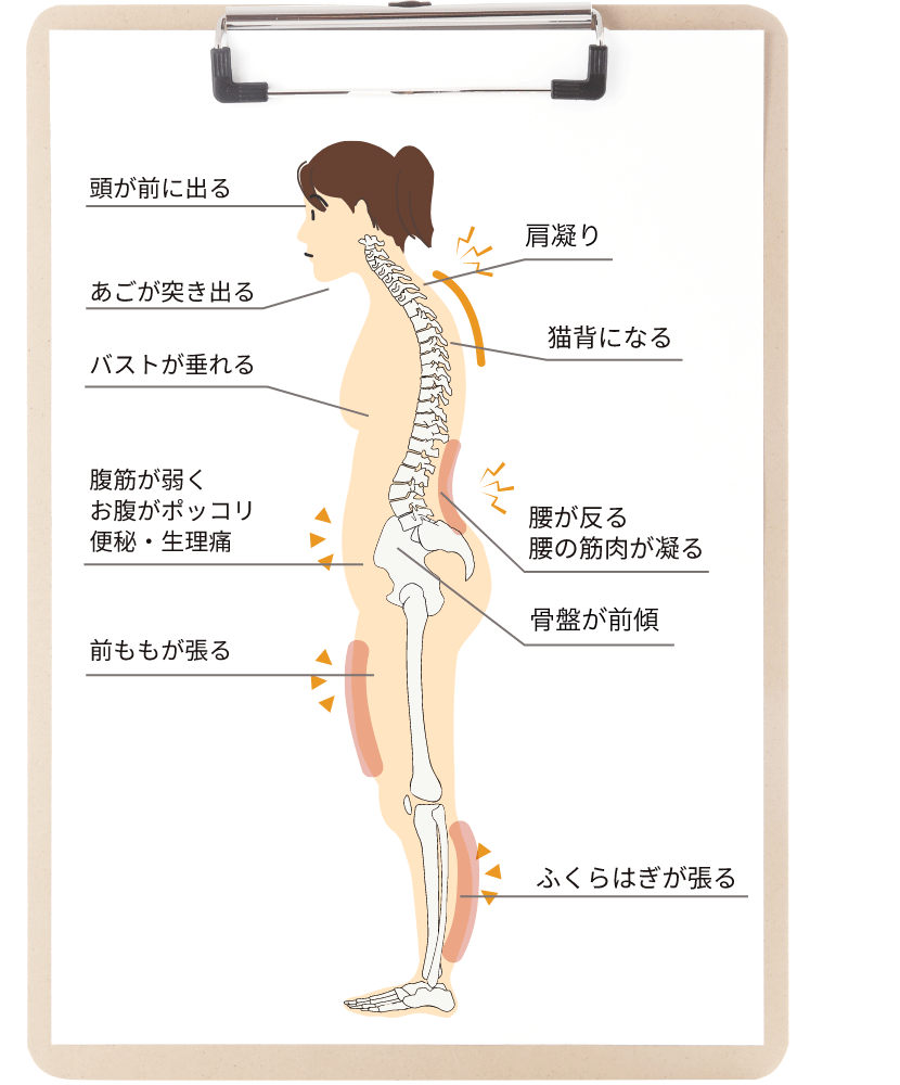 姿勢太りにはこんな症状が、、 ・頭が前にでる ・顎が突き出る ・肩こり ・猫背になる ・バストが垂れる ・腹筋が弱く、お腹がポッコリ、便秘・生理痛 ・腰が反る、腰の筋肉が凝る ・骨盤が前傾 ・前ももが張る ・ふくらはぎが張る