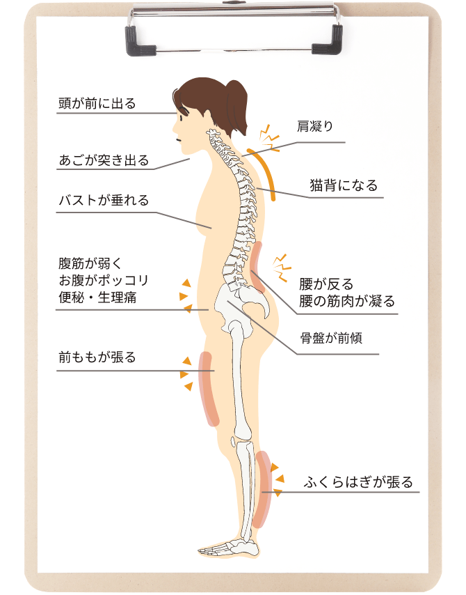姿勢太りにはこんな症状が、、 ・頭が前にでる ・顎が突き出る ・肩こり ・猫背になる ・バストが垂れる ・腹筋が弱く、お腹がポッコリ、便秘・生理痛 ・腰が反る、腰の筋肉が凝る ・骨盤が前傾 ・前ももが張る ・ふくらはぎが張る